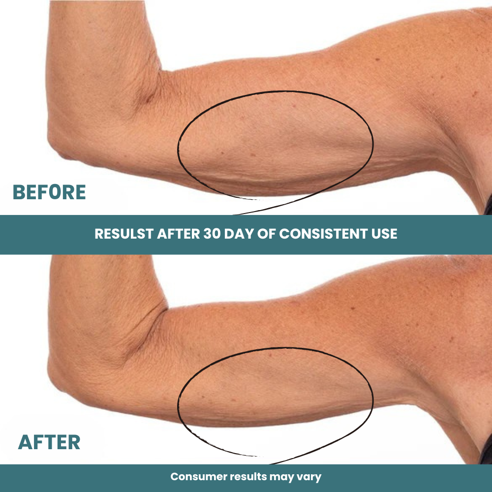 Crepey Skin Repair Treatment - 8oz.