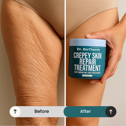 Crepey Skin Repair Treatment - 8oz.